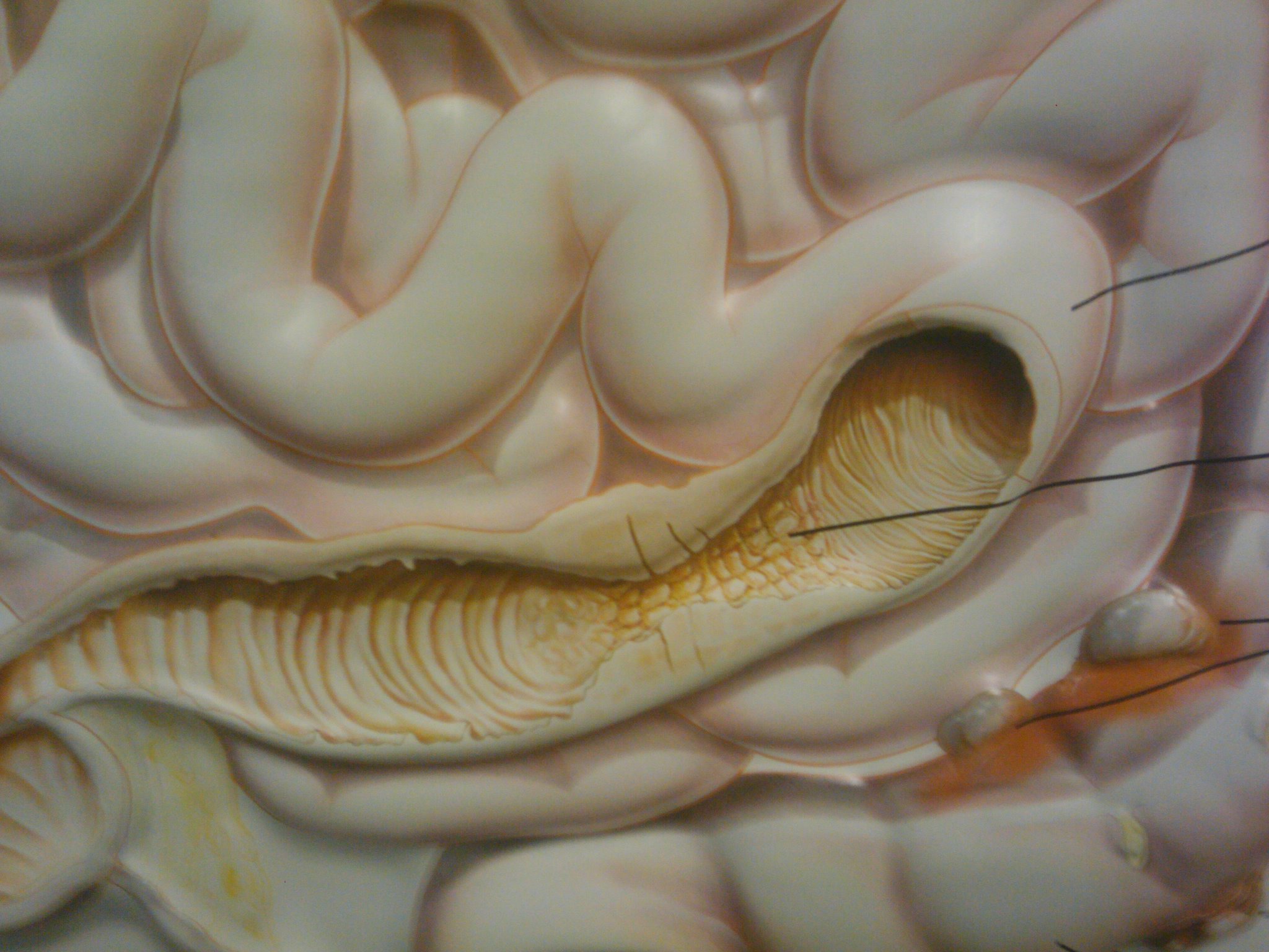 Photo of Crohn ve Ülseratif Kolit Tedavisinde Son Gelişmeler