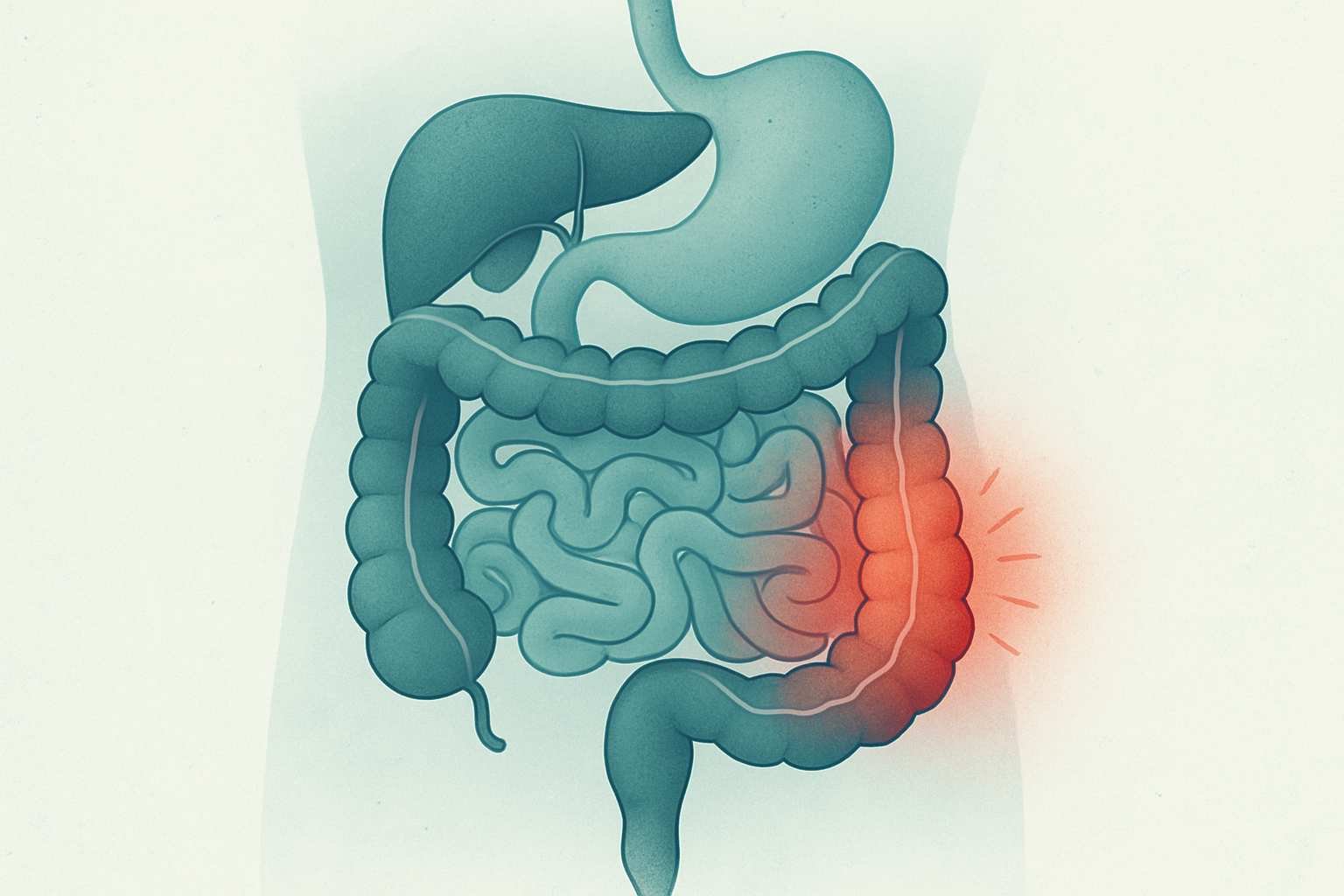Crohn Hastalığı: Belirtileri, Tanısı ve Tedavi Yöntemleri
